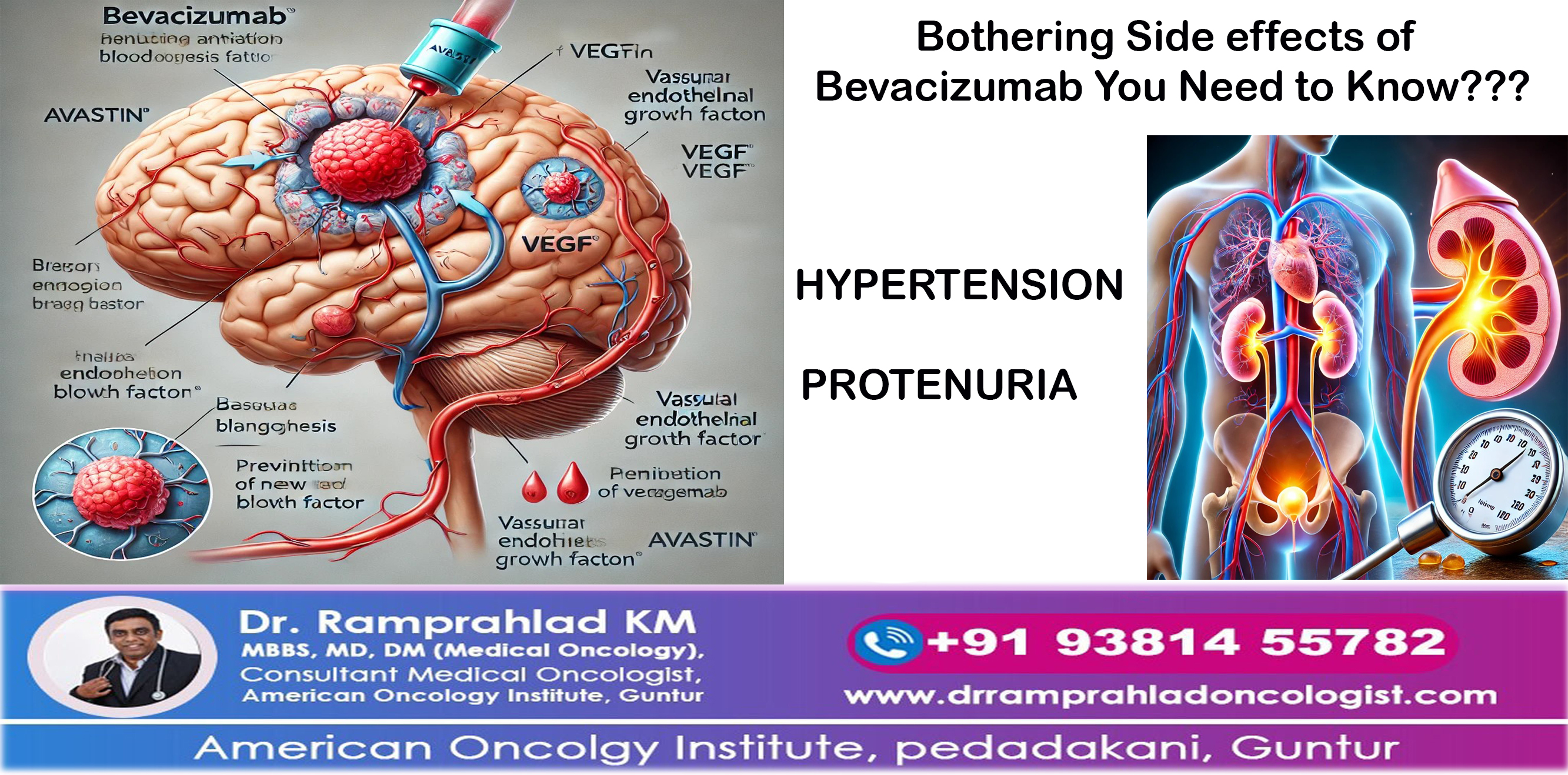 Bevacizumab Side Effects